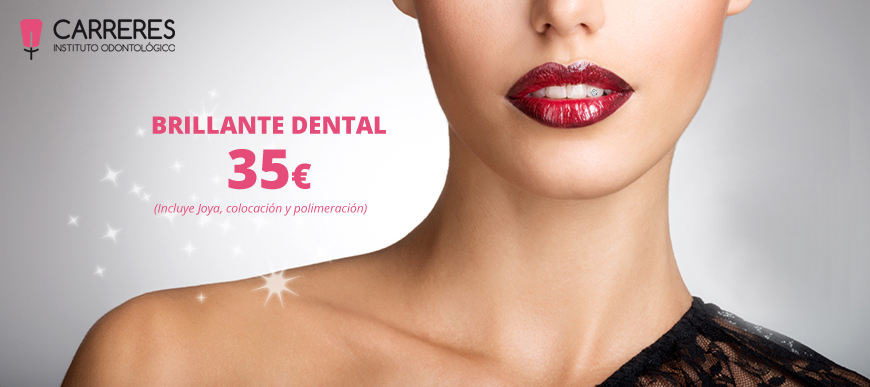 Diamante dental por 35€ en Instituto Carreres