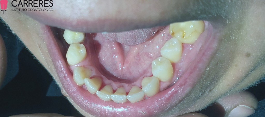 limpieza-dental-pos1-copia