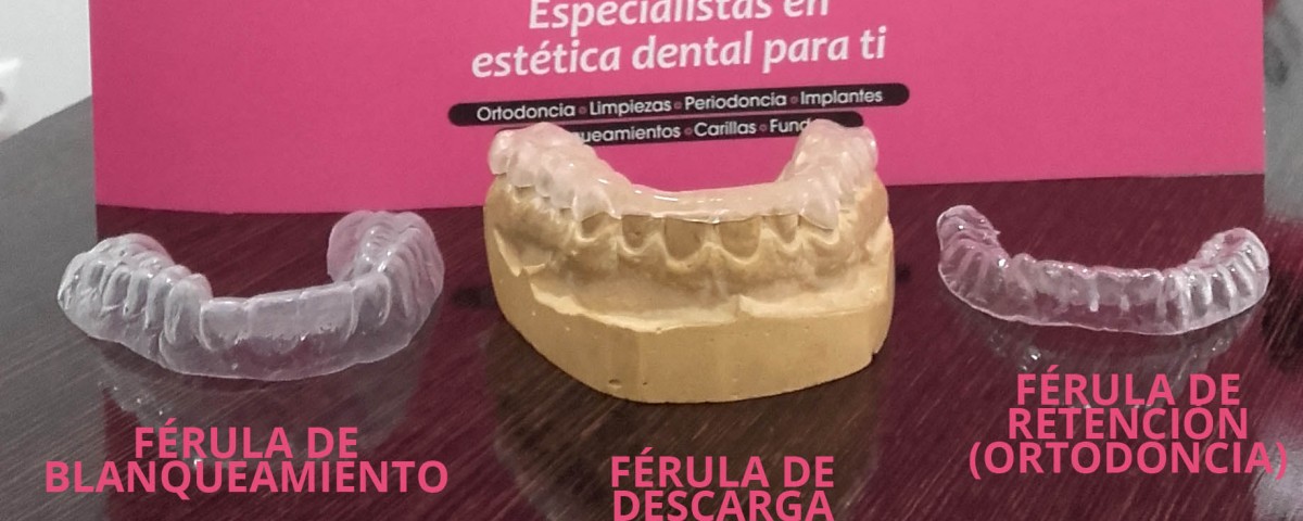 Férulas dentales, aprende a diferenciarlas